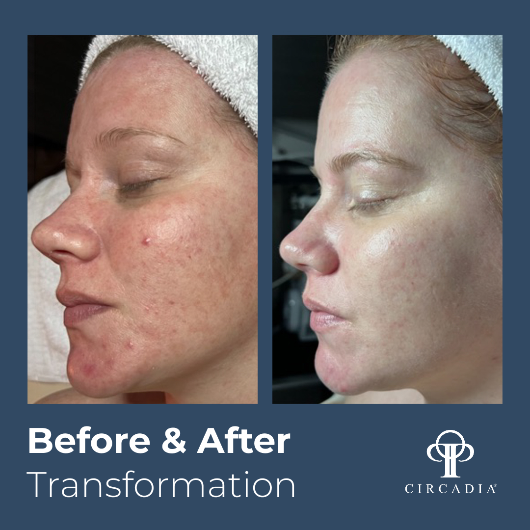 Calming Signature Facial Complete Bundle